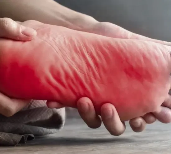 Neuropathy